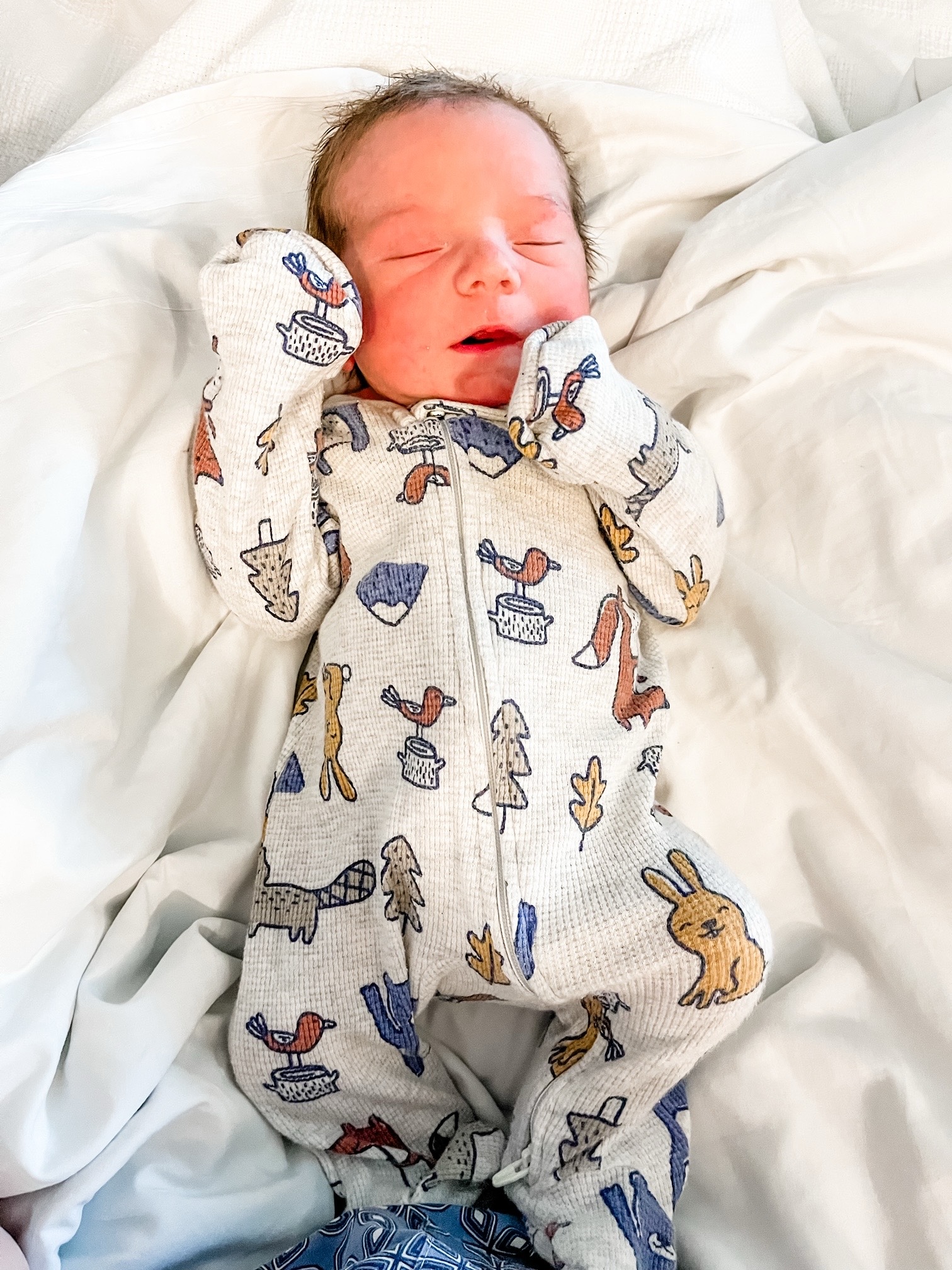 Ga vasectomy reversal baby