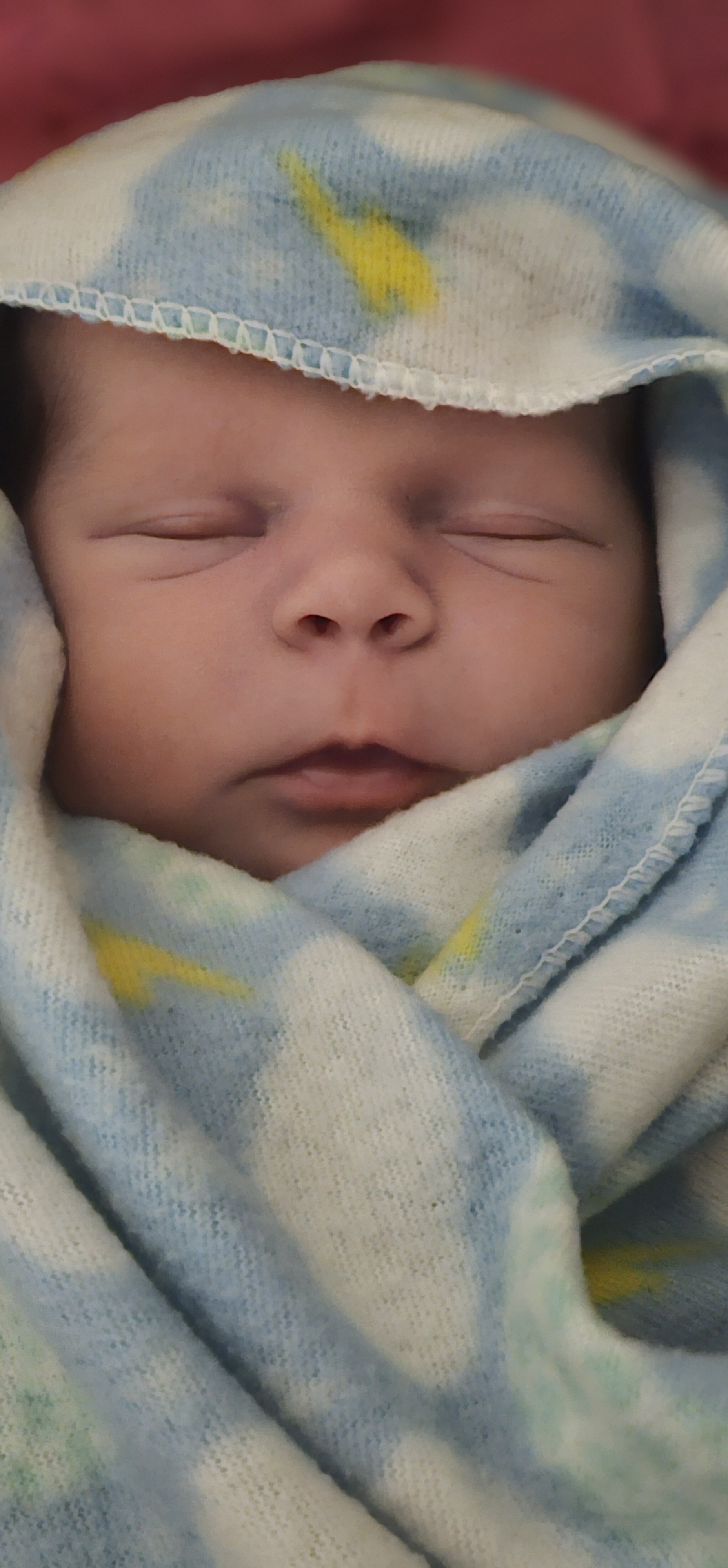 Dr. McHugh Georgia Vasectomy Reversal Baby Success